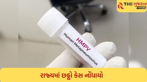 અમદાવાદમાં વધુ એક HMPV વાયરસનો કેસ નોંધાતા હડકંપ; 4 વર્ષના બાળકનો રિપોર્ટ પોઝિટિવ