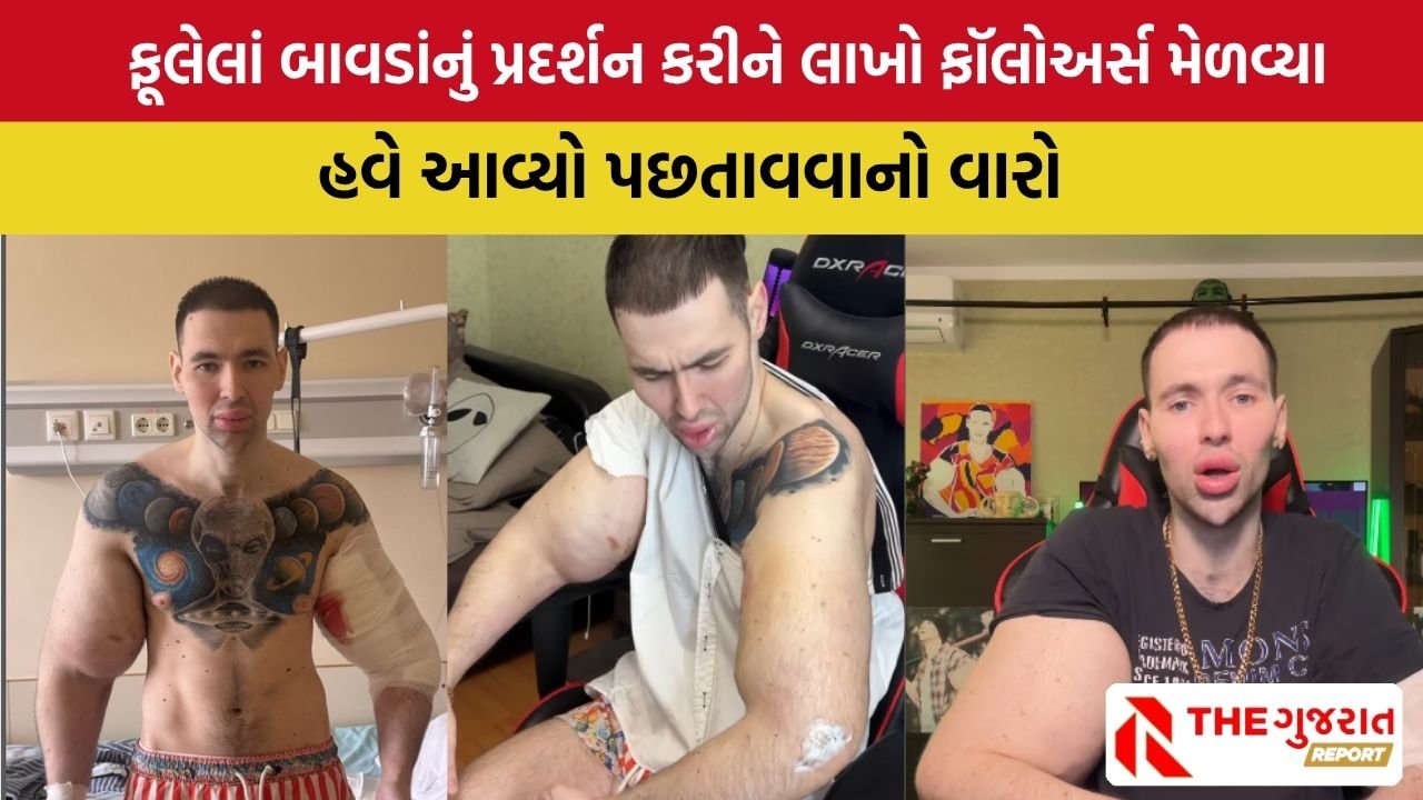 Kirill Terashin: સોશ્યલ મીડિયા ઇન્ફ્લુએન્સરને અખતરો ભારે પડ્યો,  બાવડાં બનાવવા કર્યું એવું કે હોસ્પિટલ ભેગા થવું પડ્યું