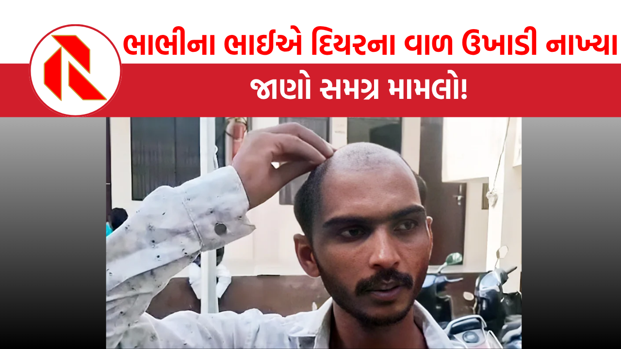  UP: બહેનને હેરાન કરતાં સાળાએ જીજાના ભાઈના વાળ ઉખાડી લીધા, હોસ્પિટલમાં ખસેડવો પડ્યો, જુઓ પછી શું થયું?