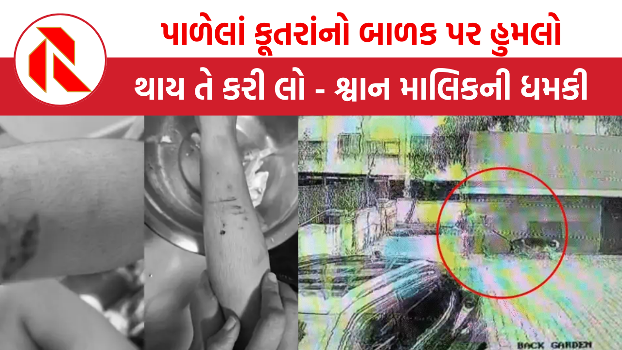 Surat News | જર્મન શેફર્ડનો બાળક પર હુમલો, થાય તે કરી લો તેવી શ્વાન માલિકની ધમકી